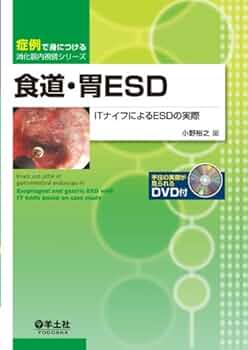 2冊セット 食道・胃ＥＳＤ　改訂版 消化器内視鏡ＤＶＤ付 食道癌診療ガイドライン 症例で身につける消化器内視鏡シリーズ：食道・胃ESD 改訂版〜IT